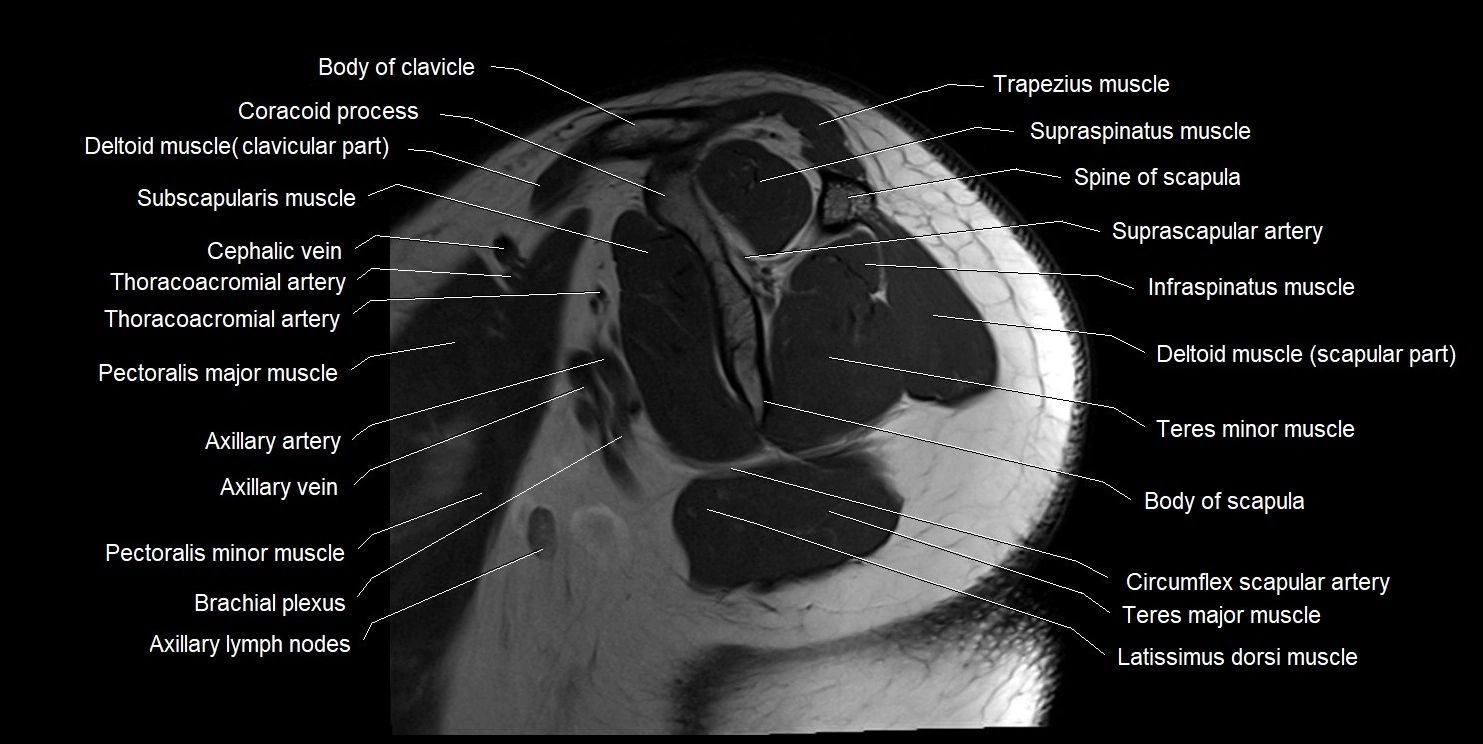 mri shoulder sagittal cross sectional anatomy image 3.webp